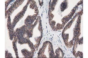 anti-Vascular Cell Adhesion Molecule 1 (VCAM1) antibody