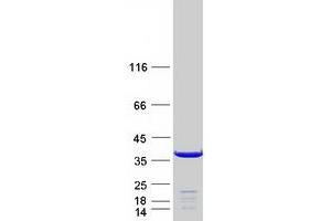 Validation with Western Blot