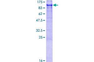 Image no. 1 for Ubiquitin Protein Ligase E3A (ube3a) (AA 1-875) protein (GST tag) (ABIN1324424)