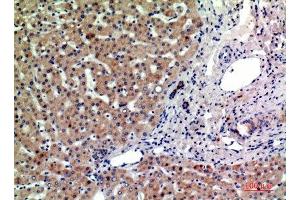 Immunohistochemical analysis of paraffin-embedded human-liver, antibody was diluted at 1:200 (PTGFRN anticorps  (Internal Region))
