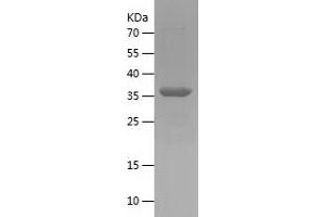 Western Blotting (WB) image for Complement Fragment C4a (C4a) (AA 1028-1336) protein (His tag) (ABIN7283446) (C4A Protein (AA 1028-1336) (His tag))