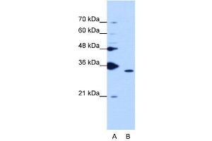 WB Suggested Anti-PPIE  Antibody Titration: 1. (PPIE anticorps  (Middle Region))