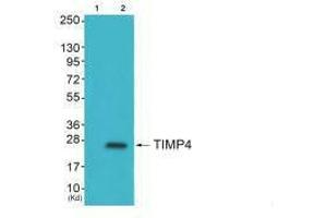 Western blot analysis of extracts from HepG2 cells (Lane 2), using TIMP4 antiobdy. (TIMP4 anticorps  (C-Term))