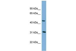WB Suggested Anti-SERPINI2  Antibody Titration: 0. (SERPINI2 anticorps  (Middle Region))