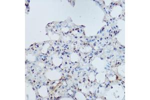 Immunohistochemistry of paraffin-embedded mouse lung using DDB1 Rabbit pAb (ABIN1679509, ABIN5664466, ABIN5664468 and ABIN6220382) at dilution of 1:350 (40x lens). (DDB1 anticorps  (C-Term))