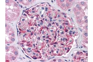 Human Kidney: Formalin-Fixed, Paraffin-Embedded (FFPE) (FRMPD4 anticorps)
