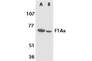 Western blot analysis of F1A alpha in mouse (A) and rat (B) liver tissue lysates with AP30325PU-N F1A alpha antibody at 1 μg/ml. (FEM1B anticorps  (C-Term))