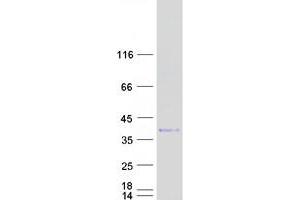 Validation with Western Blot