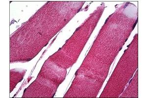Human Skeletal Muscle: Formalin-Fixed, Paraffin-Embedded (FFPE) (MMP1 anticorps  (C-Term))