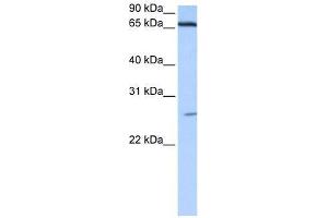 DKFZp686E2433 antibody used at 0. (ZNF879 anticorps  (N-Term))