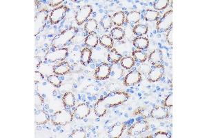 Immunohistochemistry of paraffin-embedded Mouse kidney using EPN1 Rabbit pAb (ABIN7267000) at dilution of 1:100 (40x lens).