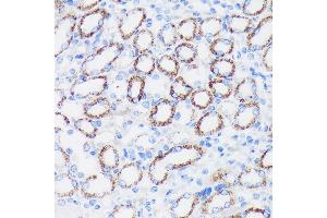 Immunohistochemistry of paraffin-embedded Mouse kidney using EPN1 Rabbit pAb (ABIN7267000) at dilution of 1:100 (40x lens). (Epsin 1 anticorps  (AA 130-180))