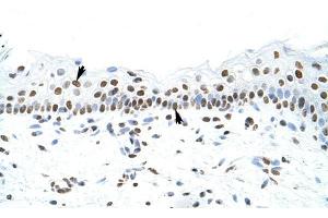 SFPQ antibody was used for immunohistochemistry at a concentration of 4-8 ug/ml to stain Squamous epithelial cells (arrows) in Human Skin. (SFPQ anticorps)
