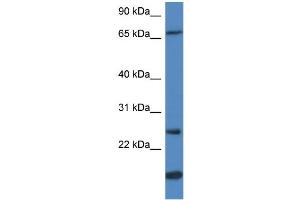 WB Suggested Anti-GSTM5 Antibody Titration:  0. (GSTM5 anticorps  (N-Term))