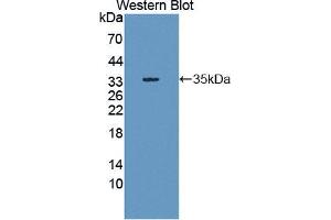 Western blot analysis of the recombinant protein. (SHP1 anticorps  (AA 244-515))