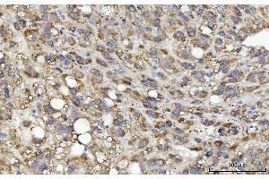 IHC analysis of MSF/SEPTIN9 using anti-MSF/SEPTIN9 antibody (ABIN7600104). (Septin 9 anticorps  (AA 15-282))