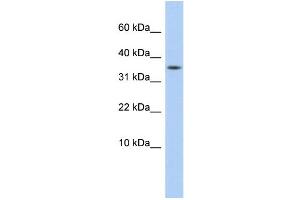 WB Suggested Anti-DYSFIP1 Antibody Titration: 0. (PPP1R27 anticorps  (Middle Region))