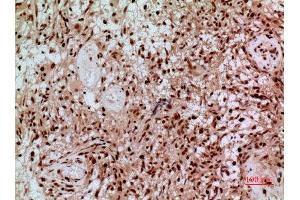 Immunohistochemistry (IHC) analysis of paraffin-embedded Human Brain, antibody was diluted at 1:100.