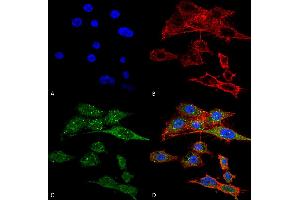Immunocytochemistry/Immunofluorescence analysis using Rabbit Anti-Rubicon Polyclonal Antibody . (Rubicon anticorps  (N-Term) (HRP))