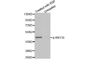 Western blot analysis of extracts from HT29 cells untreated or treated with EGF using Phospho-KRT18-S33 antibody. (Cytokeratin 18 anticorps  (pSer33))