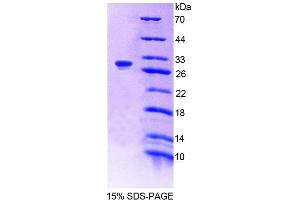 SDS-PAGE analysis of Mouse GFM1 Protein. (GFM1 Protéine)