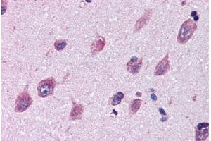 Brain, cortex, Human: Formalin-Fixed, Paraffin-Embedded (FFPE)