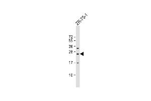 Anti-KLRF2 Antibody (N-term) at 1:1000 dilution + ZR-75-1 whole cell lysate Lysates/proteins at 20 μg per lane. (KLRF2 anticorps  (N-Term))
