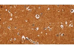 Immunohistochemistry of paraffin-embedded Human brain tissue using TNFRSF8 Polyclonal Antibody at dilution 1:60 (TNFRSF8 anticorps)