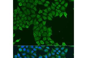Immunofluorescence analysis of U2OS cells using CDK16 Polyclonal Antibody at dilution of 1:100. (CDK16 anticorps)