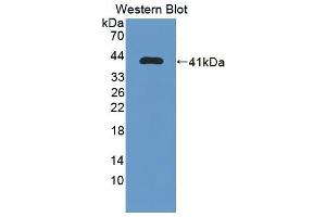 Western blot analysis of the recombinant protein. (IREB2 anticorps  (AA 1-343))