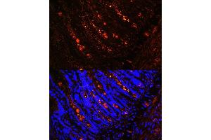 Immunofluorescence analysis of rat intestine using ITLN1 Rabbit pAb (ABIN6132446, ABIN6142601, ABIN6142602 and ABIN6223070) at dilution of 1:100 (40x lens).