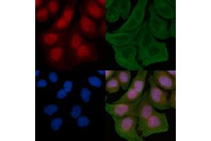 ABIN6259633 and ABIN6275638 staining Hela cells by IF/ICC. (GTF3A anticorps  (N-Term))