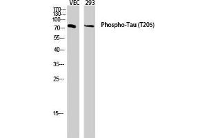 Western Blot (WB) analysis of VEC 293 lysis using Phospho-Tau (T205) antibody. (tau anticorps  (pThr205))