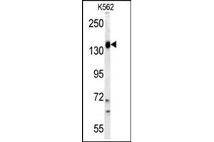 Image no. 2 for anti-Phosphoinositide-3-Kinase, Catalytic, gamma Polypeptide (PIK3CG) (AA 1073-1102), (C-Term) antibody (ABIN360452) (PIK3 gamma anticorps  (C-Term))