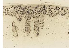 Epidermis from hairless mouse by chronic UVB irradiation after 4 weeks of treatment stained with N45. (8-OHDG anticorps)
