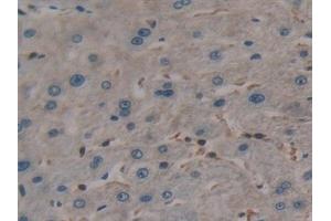 Detection of TL1A in Human Liver Tissue using Polyclonal Antibody to TNF Like Ligand 1A (TL1A)