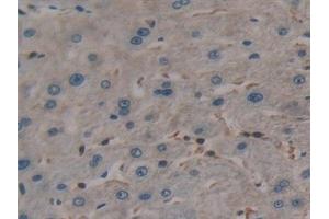 Detection of TL1A in Human Liver Tissue using Polyclonal Antibody to TNF Like Ligand 1A (TL1A) (TNF Like Ligand 1A (AA 67-251) anticorps)
