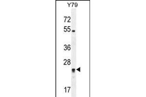 RP11-529I10. (DPCD anticorps  (AA 96-136))