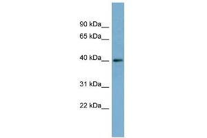 WB Suggested Anti-RP2 Antibody Titration: 0. (RP2 anticorps  (Middle Region))
