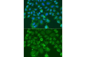 Immunofluorescence analysis of A549 cells using CST1 antibody (ABIN6293854). (CST1 anticorps)