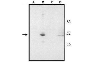 Image no. 1 for anti-Visual System Homeobox 2 (VSX2) (AA 1-131), (N-Term) antibody (ABIN265011) (VSX2 anticorps  (N-Term))