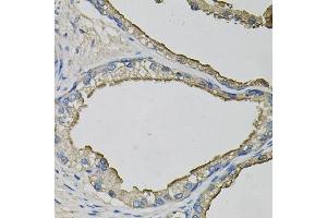 Immunohistochemistry of paraffin-embedded human prostate using LCN1 antibody  at dilution of 1:100 (40x lens). (Lipocalin 1 anticorps  (AA 19-176))