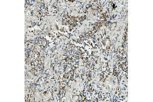 IHC analysis of Thioredoxin 2/TXN2 using anti-Thioredoxin 2/TXN2 antibody (ABIN7602149). (TXN2 anticorps  (AA 60-166))