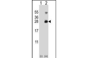 Western blot analysis of RNF11 (arrow) using rabbit polyclonal RNF11 Antibody (Center) (ABIN656832 and ABIN2846041).