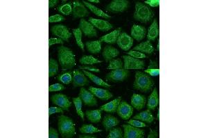 Immunofluorescence analysis of L929 cells using NDUFB3 Polyclonal Antibody (ABIN7268810) at dilution of 1:100 (40x lens). (NDUFB3 anticorps  (AA 1-98))