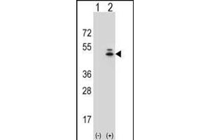Western blot analysis of ACTG1 (arrow) using rabbit polyclonal ACTG1 Antibody (Center) (ABIN390439 and ABIN2840819).