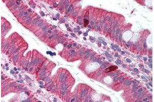 Human Small Intestine (formalin-fixed, paraffin-embedded) stained with TNFSF11 antibody ABIN214007 at 5 ug/ml followed by biotinylated goat anti-rabbit IgG secondary antibody ABIN481713, alkaline phosphatase-streptavidin and chromogen. (RANKL anticorps  (Internal Region))