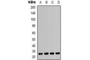 Western blot analysis of HMGB1 expression in Jurkat (A), K562 (B), MCF7 (C), A549 (D) whole cell lysates. (HMGB1 anticorps)
