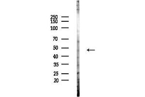 anti-serum/glucocorticoid Regulated Kinase 2 (SGK2) (pThr253) antibody