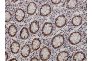 Immunoperoxidase of monoclonal antibody to FOXA1 on formalin-fixed paraffin-embedded human colon.